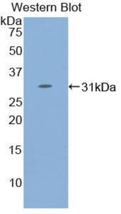 Invitrogen STAT4 Polyclonal Antibody:Antibodies:Primary Antibodies