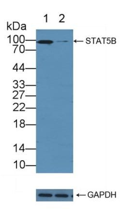 Invitrogen STAT5 beta Polyclonal Antibody 20 &mu;L; Unconjugated:Antibodies,