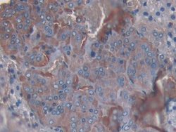 Invitrogen SLIT1 Polyclonal Antibody 200 &mu;L; Unconjugated:Antibodies,
