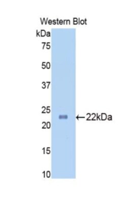 Invitrogen SLIT1 Polyclonal Antibody 200 &mu;L; Unconjugated:Antibodies,