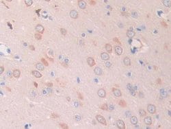 Invitrogen SLIT1 Polyclonal Antibody:Antibodies:Primary Antibodies