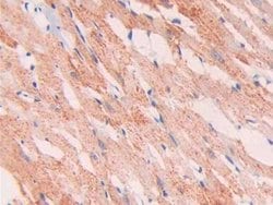 Invitrogen SLIT1 Polyclonal Antibody:Antibodies:Primary Antibodies