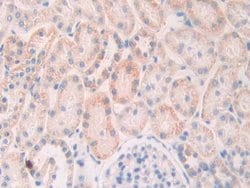 Invitrogen SLIT1 Polyclonal Antibody:Antibodies:Primary Antibodies