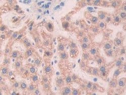 Invitrogen SLIT1 Polyclonal Antibody:Antibodies:Primary Antibodies