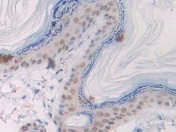 Invitrogen SLIT1 Polyclonal Antibody:Antibodies:Primary Antibodies