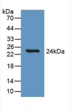 Invitrogen SLIT1 Polyclonal Antibody:Antibodies:Primary Antibodies