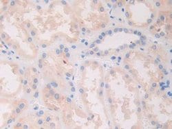 Invitrogen SLIT1 Polyclonal Antibody:Antibodies:Primary Antibodies