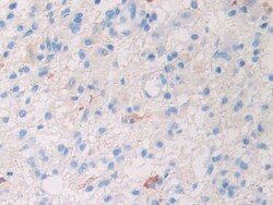 Invitrogen SLIT1 Polyclonal Antibody 200 &mu;L; Unconjugated:Antibodies,