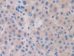 Invitrogen SLIT1 Polyclonal Antibody:Antibodies:Primary Antibodies