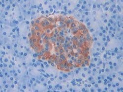 Invitrogen SLIT1 Polyclonal Antibody:Antibodies:Primary Antibodies
