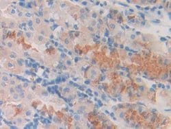 Invitrogen SLIT1 Polyclonal Antibody:Antibodies:Primary Antibodies