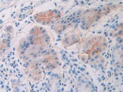 Invitrogen SLIT1 Polyclonal Antibody:Antibodies:Primary Antibodies