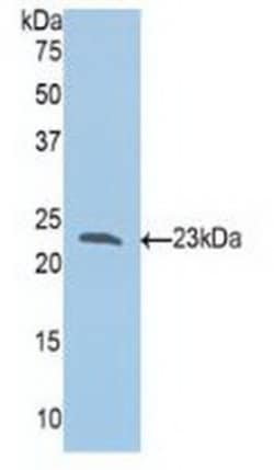 Invitrogen SLIT1 Polyclonal Antibody 200 &mu;L; Unconjugated:Antibodies,