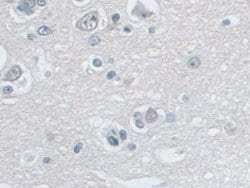 Invitrogen SNRPD1 Polyclonal Antibody 200 &mu;L; Unconjugated:Antibodies,