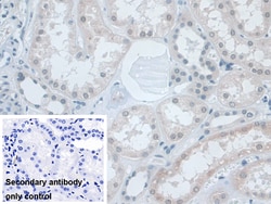 Invitrogen SNRPD1 Polyclonal Antibody 200 &mu;L; Unconjugated:Antibodies,