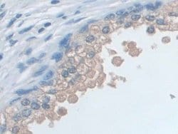 Invitrogen SNRPD1 Polyclonal Antibody 200 &mu;L; Unconjugated:Antibodies,