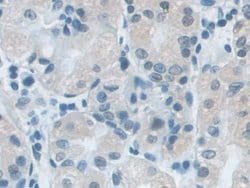 Invitrogen SNRPD1 Polyclonal Antibody 200 &mu;L; Unconjugated:Antibodies,