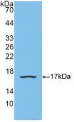 Invitrogen SNRPD1 Polyclonal Antibody 200 &mu;L; Unconjugated:Antibodies,