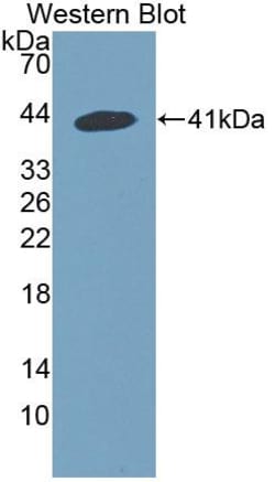 Invitrogen SNUPN Polyclonal Antibody:Antibodies:Primary Antibodies