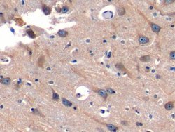 Invitrogen SNUPN Polyclonal Antibody:Antibodies:Primary Antibodies