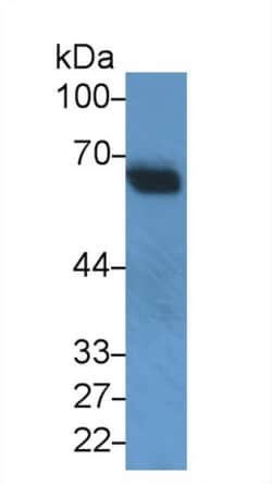 Invitrogen SNUPN Polyclonal Antibody 20 &mu;L; Unconjugated:Antibodies,