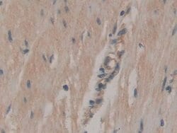 Invitrogen CD298 Polyclonal Antibody 20 &mu;L; Unconjugated:Antibodies,