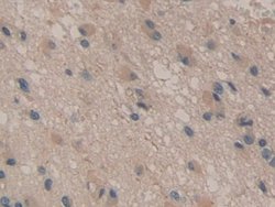 Invitrogen CD298 Polyclonal Antibody 20 &mu;L; Unconjugated:Antibodies,