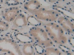 Invitrogen CD298 Polyclonal Antibody 20 &mu;L; Unconjugated:Antibodies,