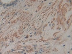 Invitrogen CD298 Polyclonal Antibody 20 &mu;L; Unconjugated:Antibodies,