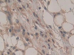 Invitrogen CD298 Polyclonal Antibody 20 &mu;L; Unconjugated:Antibodies,