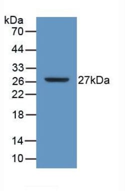 Invitrogen CD298 Polyclonal Antibody 20 &mu;L; Unconjugated:Antibodies,