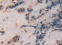 Invitrogen SP100 Polyclonal Antibody:Antibodies:Primary Antibodies