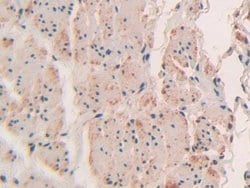 Invitrogen SP100 Polyclonal Antibody:Antibodies:Primary Antibodies