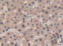 Invitrogen SP100 Polyclonal Antibody:Antibodies:Primary Antibodies