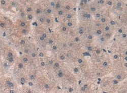 Invitrogen SP100 Polyclonal Antibody:Antibodies:Primary Antibodies