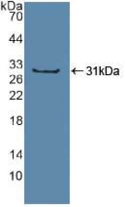 Invitrogen SP100 Polyclonal Antibody:Antibodies:Primary Antibodies