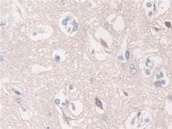 Invitrogen SPARCL1 Polyclonal Antibody 200 &mu;L; Unconjugated:Antibodies,
