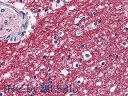 Invitrogen SPARCL1 Polyclonal Antibody 200 &mu;L; Unconjugated:Antibodies,