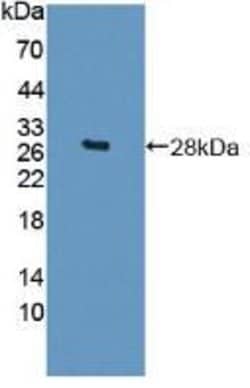Invitrogen Sp17 Polyclonal Antibody:Antibodies:Primary Antibodies