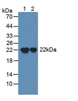 Invitrogen Sp17 Polyclonal Antibody 20 &mu;L; Unconjugated:Antibodies,