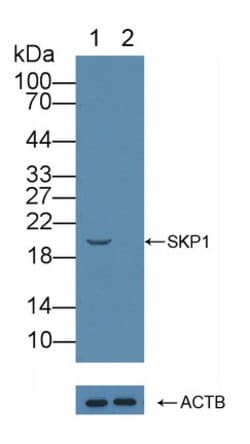 Invitrogen SKP1 Polyclonal Antibody 200 &mu;L | Buy Online | Invitrogen&trade; | Fisher Scientific