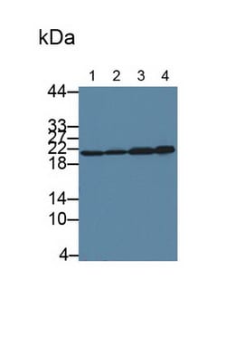 Invitrogen SKP1 Polyclonal Antibody 200 &mu;L | Buy Online | Invitrogen&trade; | Fisher Scientific