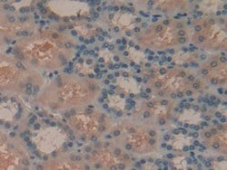 Invitrogen Syk Polyclonal Antibody 20 &mu;L | Buy Online | Invitrogen&trade; | Fisher Scientific