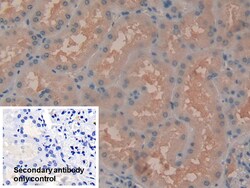 Invitrogen Syk Polyclonal Antibody 20 &mu;L | Buy Online | Invitrogen&trade; | Fisher Scientific