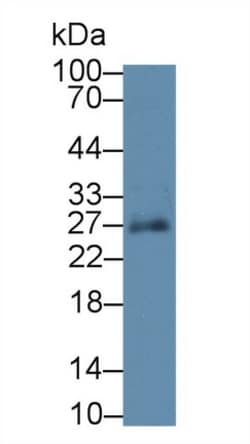 Invitrogen SPRY3 Polyclonal Antibody:Antibodies:Primary Antibodies