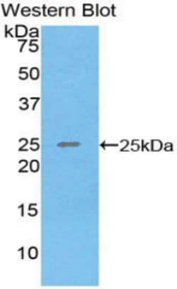 Invitrogen SPRY3 Polyclonal Antibody 200 &mu;L; Unconjugated:Antibodies,