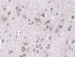 Invitrogen STIP1 Polyclonal Antibody 200 &mu;L; Unconjugated:Antibodies,