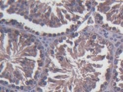 Invitrogen SDF2L1 Polyclonal Antibody:Antibodies:Primary Antibodies