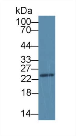 Invitrogen SDF2L1 Polyclonal Antibody:Antibodies:Primary Antibodies