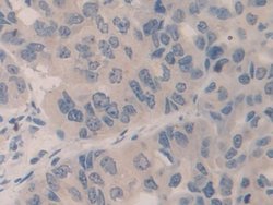 Invitrogen SMC3 Polyclonal Antibody:Antibodies:Primary Antibodies